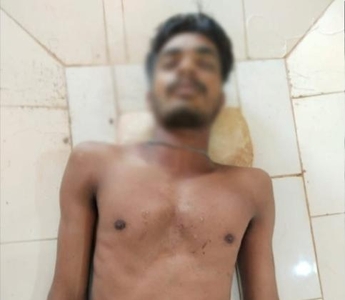 ವಿಟ್ಲ: ಈಜಲು ಬಾರದೆ 24ರ ಹರೆಯದ ಯುವಕ ಜಾರಿ ಬಿದ್ದು ಮೃತ್ಯು; ಕುದ್ದುಪದವು ಬಳಿ ಇರುವ ಕಲ್ಲಿನ ಕೋರೆಯಲ್ಲಿ ನಡೆದ ದುರ್ಘಟನೆ