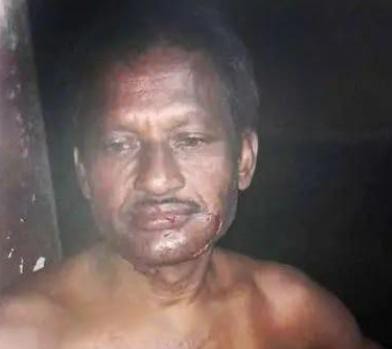 ಉಡುಪಿ: ಮನೆಯ ಜಗಲಿಯಲ್ಲಿ ಮಲಗಿದ್ದ ವ್ಯಕ್ತಿ ಮೇಲೆ ಚಿರತೆ ದಾಳಿ; ಗಂಭೀರ ಗಾಯ