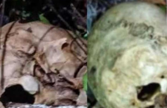 ಕಡಬ : ಬಿಳಿನೆಲೆ ಕಾಡಿನಲ್ಲಿ ಮನುಷ್ಯ ತಲೆಬುರುಡೆ ಪತ್ತೆ