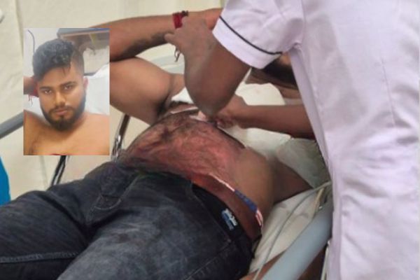 ಬಂಟ್ವಾಳ : ರೌಡಿ ಶೀಟರ್ ಗೆ ಚೂರಿ ಇರಿತ, ಆಸ್ಪತ್ರೆಗೆ ದಾಖಲು..!