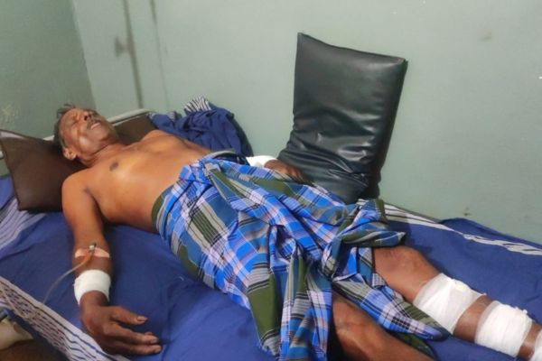 ಪುತ್ತೂರು : ಕೃಷಿಕನ ಮೇಲೆ ಕಾಡುಹಂದಿ ದಾಳಿ- ಗಂಭೀರವಾಗಿ ಗಾಯ