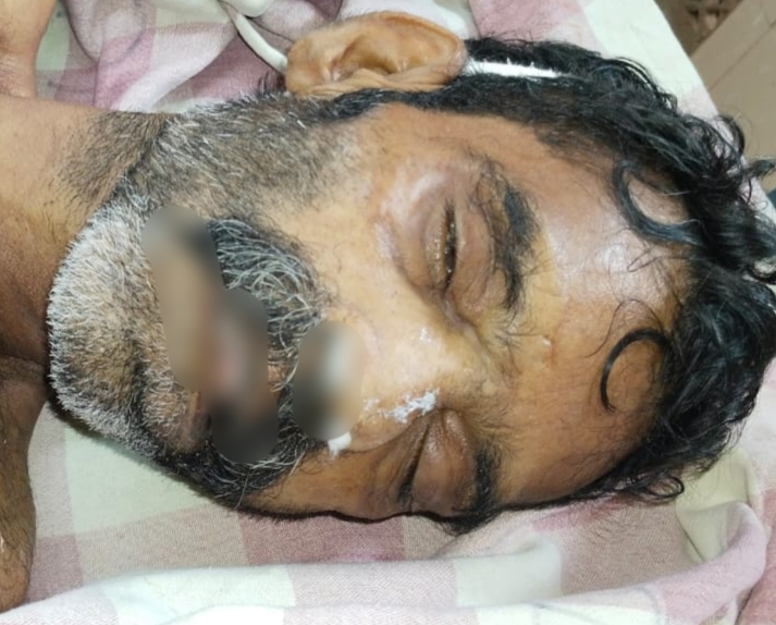 ನಾಲ್ಕು ದಿನದ ಹಿಂದೆ ಅರಂಬೂರಿನಲ್ಲಿ ಪ್ರಜ್ಞಾಹೀನ ಸ್ಥಿತಿಯಲ್ಲಿ ಪತ್ತೆಯಾಗಿದ್ದ ಅಪರಿಚಿತ ವ್ಯಕ್ತಿ ಆಸ್ಪತ್ರೆಯಲ್ಲಿ ಸಾವು.