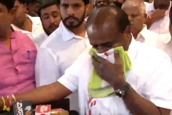 ಸುದ್ದಿಗೋಷ್ಠಿ ವೇಳೆ ಏಕಾಏಕಿ ಕೇಂದ್ರ ಸಚಿವ ಹೆಚ್ ಡಿ ಕುಮಾರಸ್ವಾಮಿ ಮೂಗಿನಿಂದ ಹರಿದ ರಕ್ತ