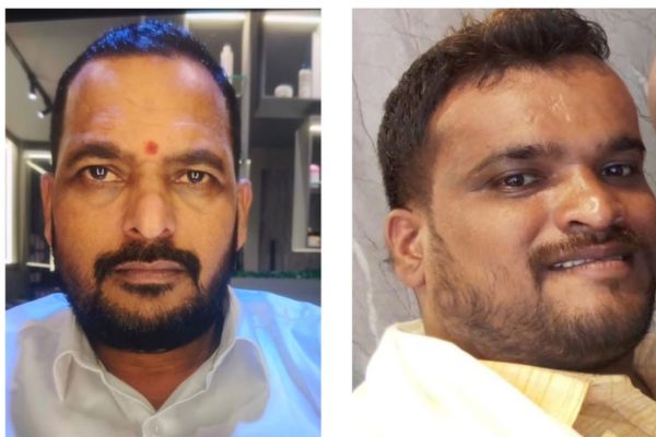 ಕಾರ್ಕಳ : ಹೋಂ ನರ್ಸ್ನಿಂದ 9 ಲ.ರೂ ವಂಚನೆ ಪ್ರಕರಣ- ಇಬ್ಬರು ಆರೋಪಿಗಳು ಅರೆಸ್ಟ್..!